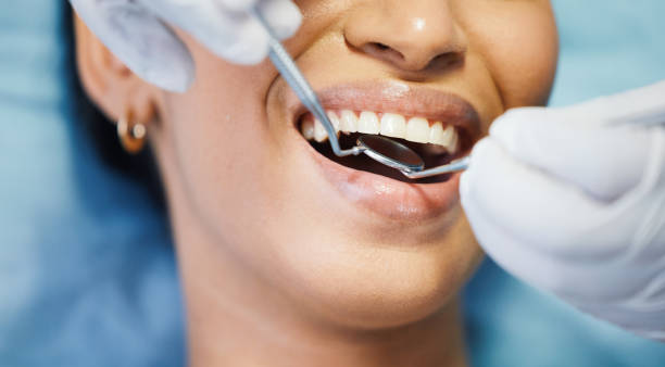 Best Emergency Denture Repair in Elmwood Place, OH
