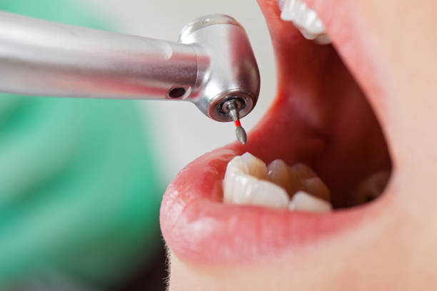 Best Emergency Treatment for Dental Infections or Abscesses in Elmwood Place, OH
